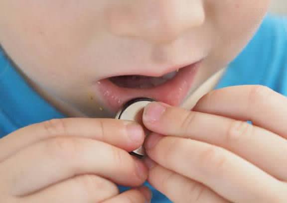 Pide IMSS Veracruz Sur prevenir accidentes por ingesta de objetos en niñas y niños