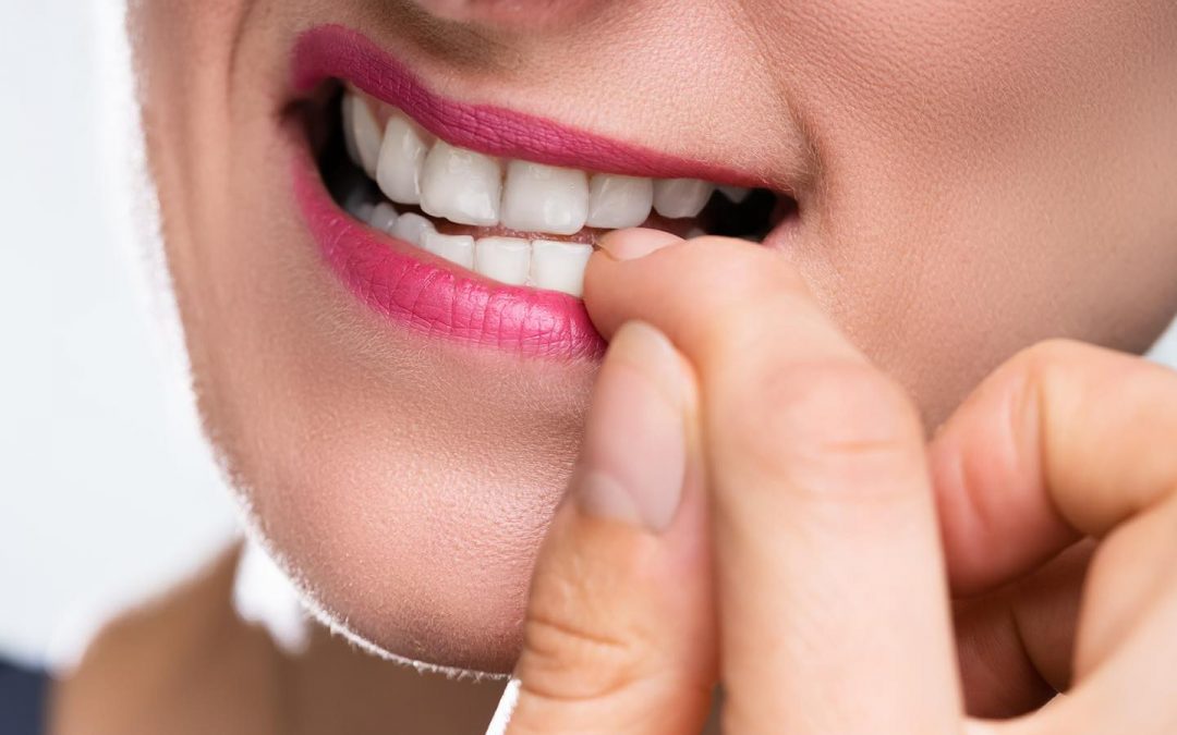 La “onicofagia” (morderse las uñas) no es normal, ocasiona daños a la salud