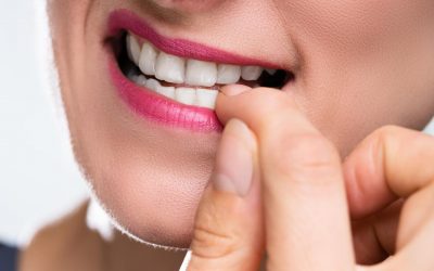 La “onicofagia” (morderse las uñas) no es normal, ocasiona daños a la salud