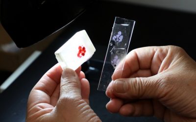 Promueve IMSS Veracruz Sur autoexploración para detección oportuna de enfermedades